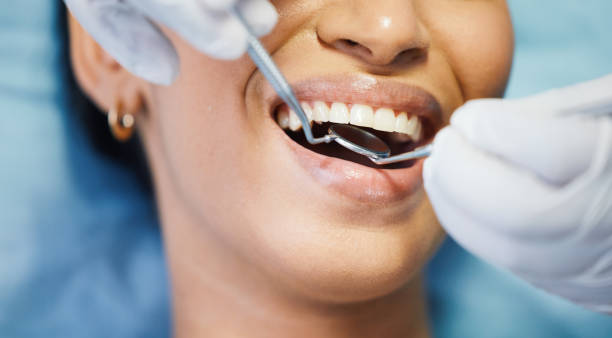 Best Emergency Dentist for Lost Fillings or Crowns in Kure Beach, NC